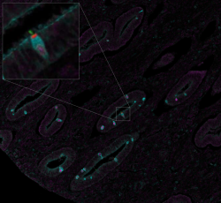 News image of the month March 2025 CFAP45 endometrium glands merge.PNG