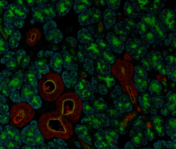 News image of the month April 2025 CRACR2A salivary gland.PNG