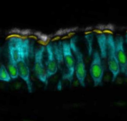 News image of the month July 2025 RFX2 nasopharynx 4.PNG