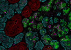 News image of the month August 2025 LTF salivary gland 3.PNG