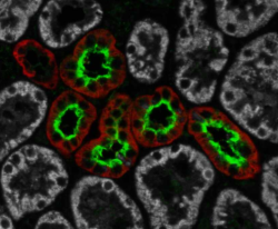 News image of the month November 2025 TMEM52B kidney 2.PNG